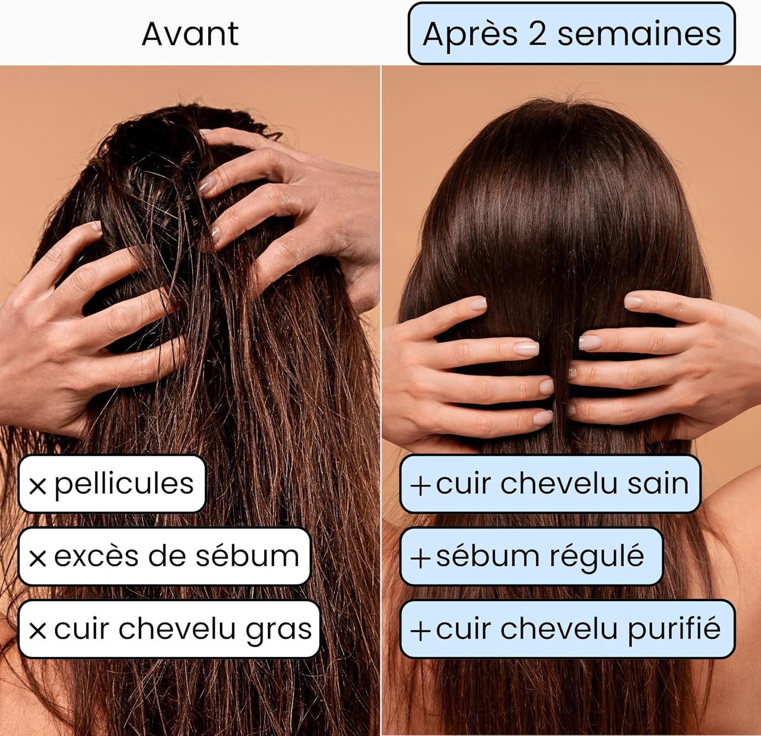Shampoing Solide bio pour Cheveux Gras - Shampooing Purifiant anti Pellicules au charbon végétal et à l'orange, sans savon - 100% Vegan Naturel - 130gr 130 g (Lot de 1)