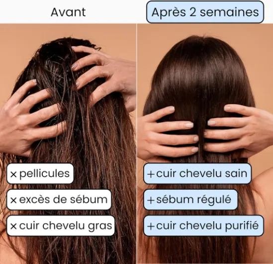 Shampoing Solide bio pour Cheveux Gras - Shampooing Purifiant anti Pellicules au charbon végétal et à l'orange, sans savon - 100% Vegan Naturel - 130gr 130 g (Lot de 1)