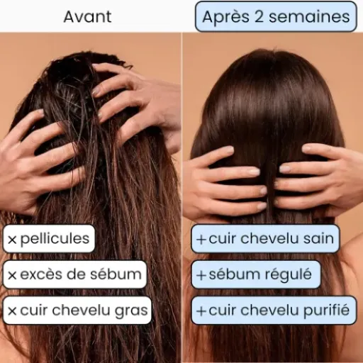 Test ENOOSO Shampoing Solide Cheveux Gras : efficace, mais pas magique non plus