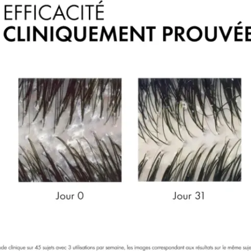 Test Vichy Dercos Shampooing Anti-Pelliculaire DS : enfin un truc sérieux contre les pellicules et les démangeaisons